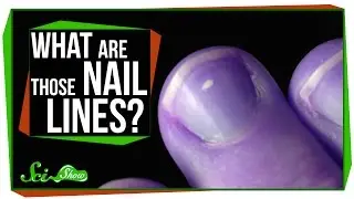What Are Those Lines on My Nails?