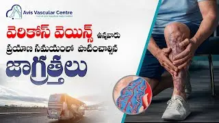 Traveling with Varicose Veins? Protect Your Legs | Dr Rajah V Koppala | Avis Hospitals Jubilee Hills