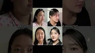 VIEW Plastic Surgery in Korea 🇰🇷  #korea #seoul #beauty #kbeauty #skincare#kpop #glowup #korean