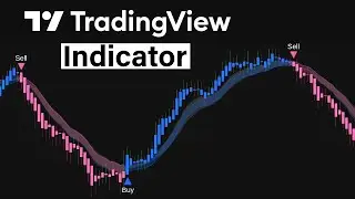 After a Decade of Trading, I Found the Most Accurate Settings Ever!