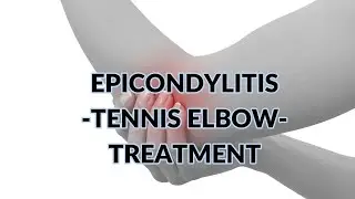 ShockWave Dual Power - Epicondylits