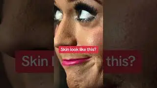 SKIN LOOK LIKE THIS? YOU NEED TO TRY DERMAPLANING #shorts