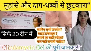 मुहांसे और दाग-धब्बों से छुटकारा