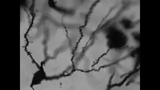 Digitized neuron morphology