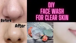 DIY FACE WASH FOR CLEAN,CLEAR &GLOWING SKIN: घर पर बनाए FACE WASH इंस्टेंट निखार चमकदार स्किन केलिए