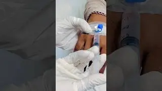 Iv injection in cannula/ Iv line