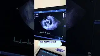 Today&rsquo;s patient came in for a heart checkup!