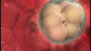 IVF kurz erkl&auml;rt
