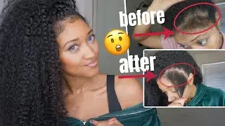 How I Grew My Struggle Edges Back | Natural Hair Growth Tips