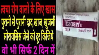 दाद,खुजली कैसा से भी हो उसे 24 घण्टे में खत्म किजिये बहुत ही कारगर क्रीम।Tigboderm Cream Uses।