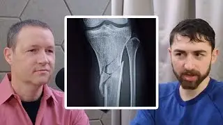 Nick Norwitz - Elite Runner with a Bone Density of 80-Year-Old