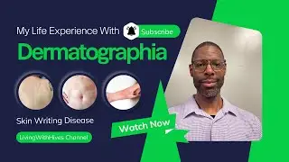 My Experience Living With DERMATOGRAPHIA. (DERMATOGRAPHISM URTICARIA)