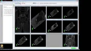 SMILI DICOM Viewing and Conversion