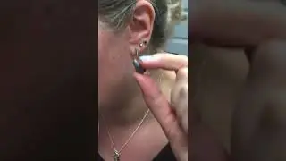 The Hearing Spa: How to insert a Titanium hearing aid.