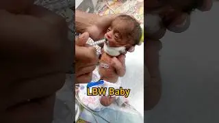 So cute 🥰 baby NICU #youtubeshorts #short #nicu #cutebabycarebaby
