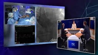How to approach the challenges of large annuli in TAVI - Webinar
