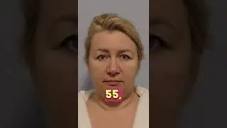 Тотальное омоложение лица помогло Изольде выглядеть на 30 с хвостиком