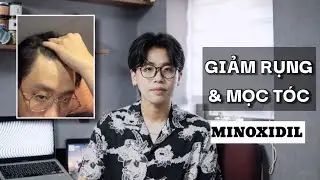 5 Biện Pháp Giảm Rụng/Kích Thích Mọc Tóc | Đánh Giá Hiệu Quả Sau Khi Trải Nghiệm