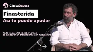 Finasterida y alopecia masculina: as&iacute; te puede ayudar