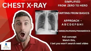 HOW TO READ CHEST X-RAY , SIMPLIFIED, IN DETAIL, EASY, MASTER FROM BASICS, FOR MBBS/NURSING/NEETPG