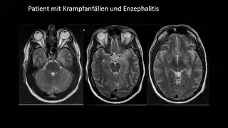Keine Angst vor R&ouml;ntgenbildern im Hammerexamen - Teil 2 | DRG