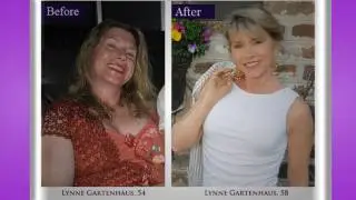 Cenegenics Body, Health, Vitality and Wellness Transformations