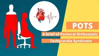 POTS - Postural Orthostatic Tachycardia Syndrome - Haynes Acupuncture Gold Coast