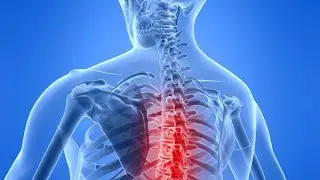 Dolor Cronico con Dr. Wuollet In Pain? Call 480-845-0564 Today!