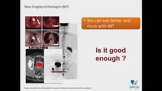 Metastasis-Directed Therapy for Oligometastatic Prostate Cancer – Prof. Bertrand Tombal, MD, PhD