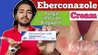 Eberconazole Cream 1% | Eberfine Eberconazole cream % Review In Hindi | Anti Fungal Cream