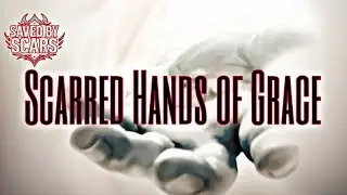 Saved By Scars - Scarred Hands of Grace
