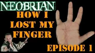 How I Lost My Finger: Episode 1