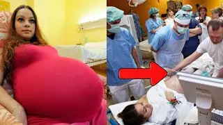 🔴It Happens Once Every 480 Years! When the Doctors Saw it, They Couldn't Believe It!