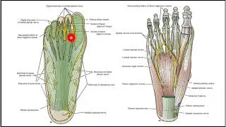 Sole of Foot | All Layers OSPE flashcards | Gross Anatomy | Block 2 | Lower Limb