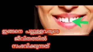 ഇങ്ങനെ പല്ലുള്ളവരുടെ വീട്ടിൽ സംഭവിക്കുന്ന ഞെട്ടിക്കുന്ന കാര്യങ്ങൾ
