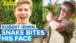 Robert Irwin bitten on face by snake | Today Show Australia