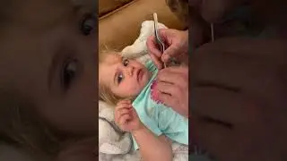 Dad has to use tweezers to remove a pony bead from his daughter's nose!