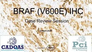 CADQAS Proficiency Test Case Review Session for PT 1024 BRAF V600E in all indications