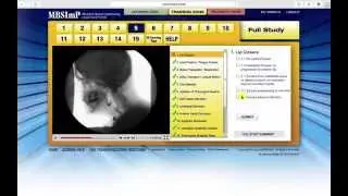 MBSImP Overview - Training Zone