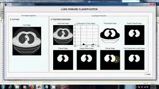 Lung Disease Classification using Machine Learning | Medical Image Processing Projects | MATLAB