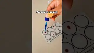 Comment result 🩸🔬....#bloodgroup #labtechnician #laboratorylife #laboratorywork #medical #medical