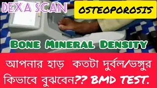 #bmd#bone#mineral#density#test #osteoporosis#osteopatia#drmujibar#treatment#dexa#scan#fracture   .