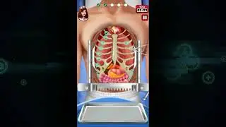 Open Heart Surgery Doctor Games | New Gameplay Trailer 2 | Hospital Surgery Games