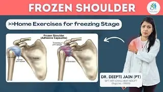 Frozen shoulder Treatment |Frozen Shoulder: Home exercises for Freezing stage