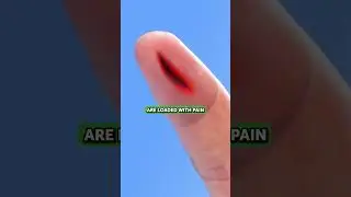 Why do paper cuts hurt so much? ✂️