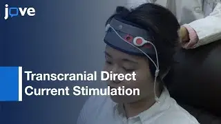 Transcranial Direct Current Stimulation For Online Gamers l Protocol Preview