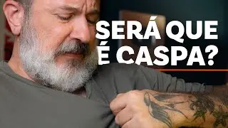 Sua CASPA NA BARBA pode N&Atilde;O SER Caspa na Barba (Descubra)