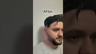 Transformare completă!Noua tunsoare și proteza capilară te redefinesc.Ai &icirc;ncredere &icirc;n noul tău look!