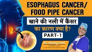 What is esophagus cancer / food pipe cancer? | खाने की नली में कैंसर का कारण क्या है?