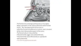 Frontal sinus drainage pathway